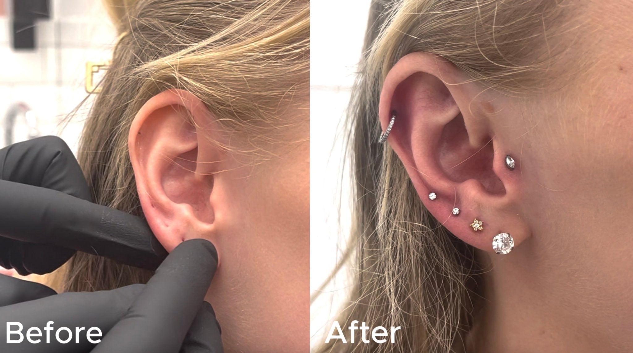 Full Ear Makeover for a Wedding - Lulu Ave