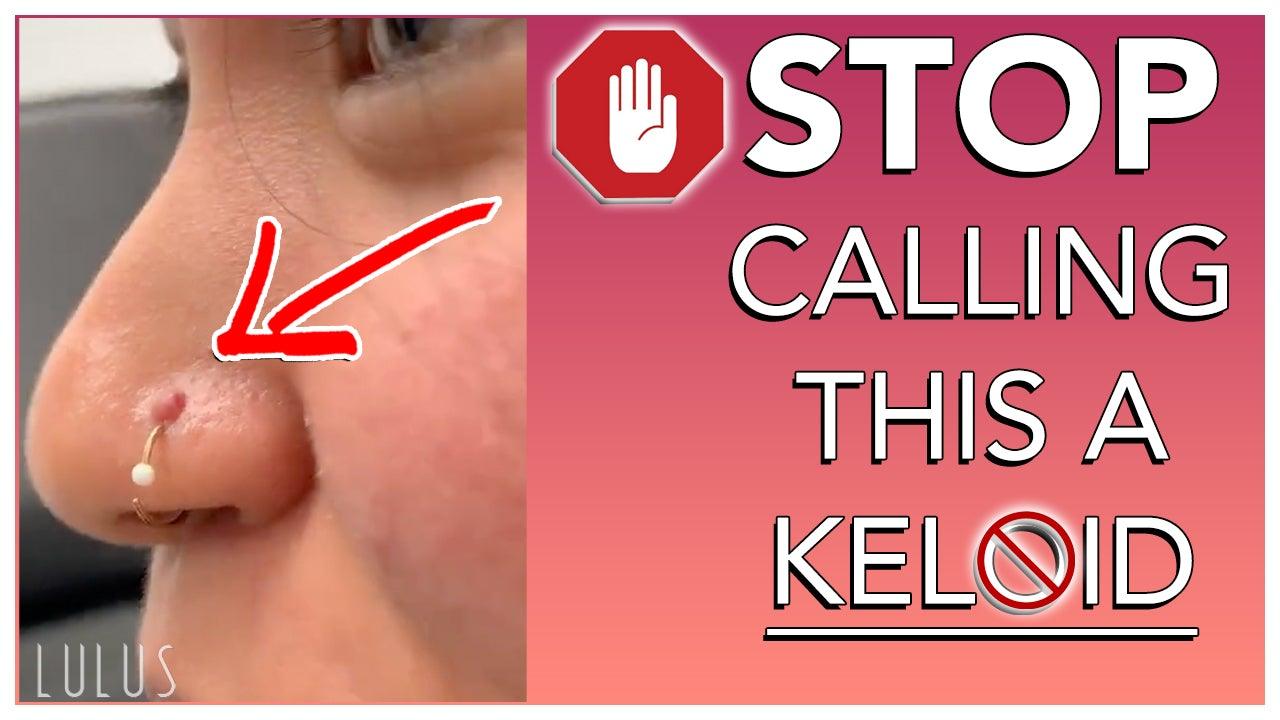 STOP CALLING BUMPS ON YOUR PIERCING KELOIDS!! - Lulu Ave