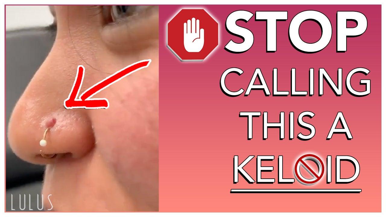 STOP CALLING BUMPS ON YOUR PIERCING KELOIDS!! - Lulu Ave 